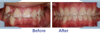 Hiremath Ortho