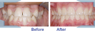 Hiremath Ortho