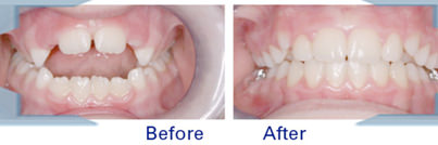 Hiremath Ortho