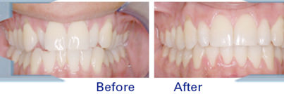 Hiremath Ortho